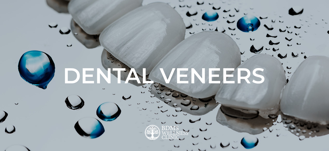 Premium Dental Veneers in Bangkok